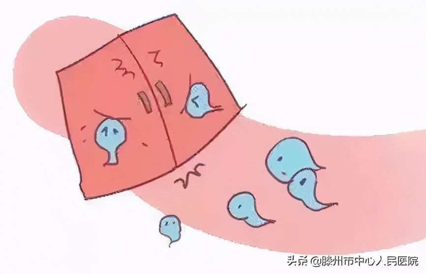 妇科宫腔镜微创手术,宫腔镜妇科微创手术