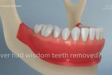 手术的时候医生对你做了什么,手术时切了一片肺叶