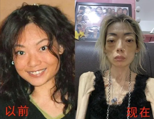 女人因肥胖被老公嫌弃,女子因肥胖被老公嫌弃离婚后减肥