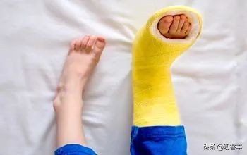 脚踝骨折手术后怎么预防血栓,脚踝骨折怎么按摩预防肌肉萎缩