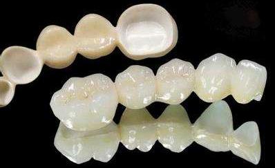 牙齿小知识烤瓷牙,牙医牙齿美白要做吗