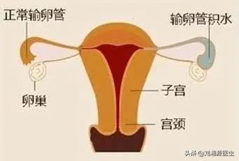 【免疫相关不良妊娠答疑解惑15】——辅助生殖(4)