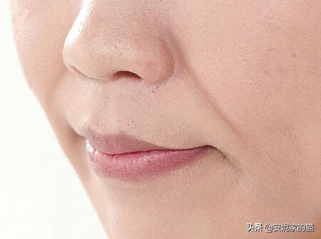 法令纹怎么解决最显老,法令纹显老10岁三种方法帮助改善