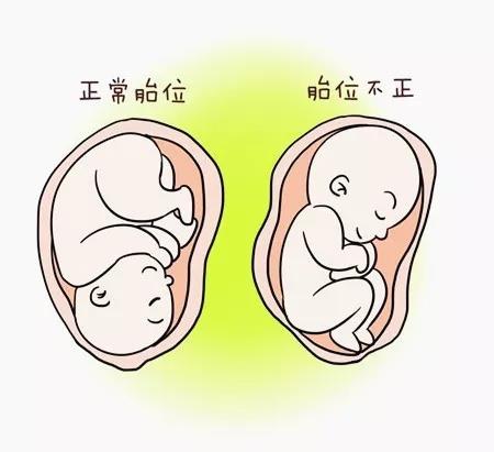 39周胎位不正能转过来吗,胎位不正怎么转胎位图解