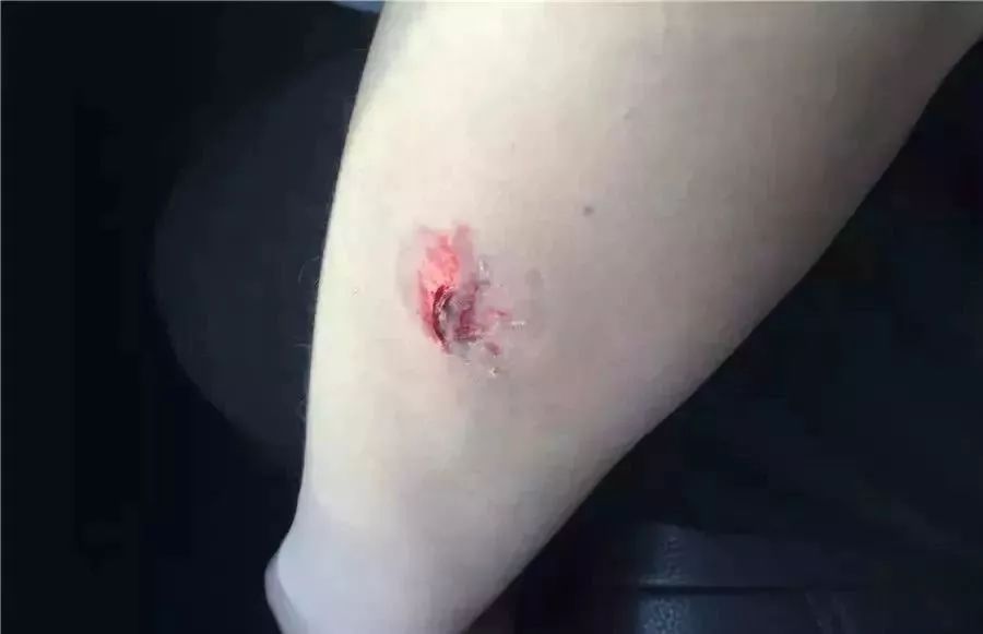 缉毒警察抓吸毒人员吗,缉毒警察疑感染艾滋病