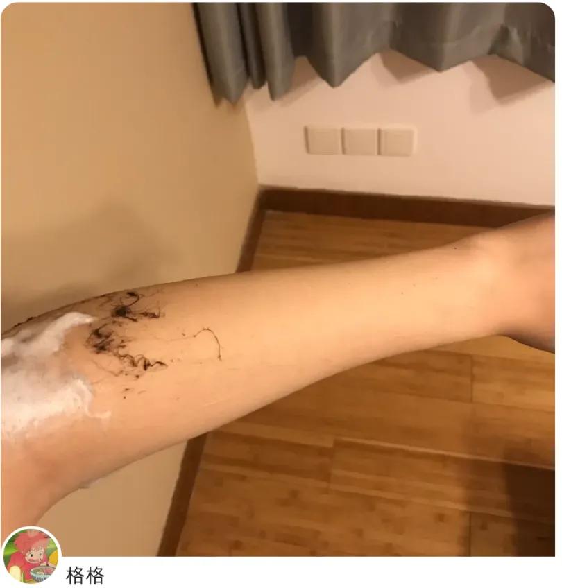 每个人的身上都有小毛毛,每个人的身上都有毛毛没有腿毛吗