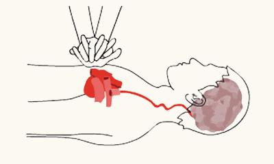 护士面试心肺复苏答题步骤,心肺复苏面试视频教程