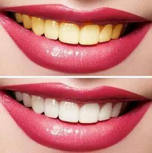 一口黄牙毁了一张脸视频,一口黄牙影响颜值