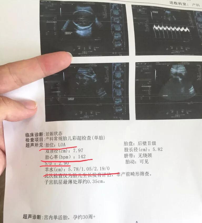 胎儿健康程度做什么检查,怎样能看出胎儿是否健康