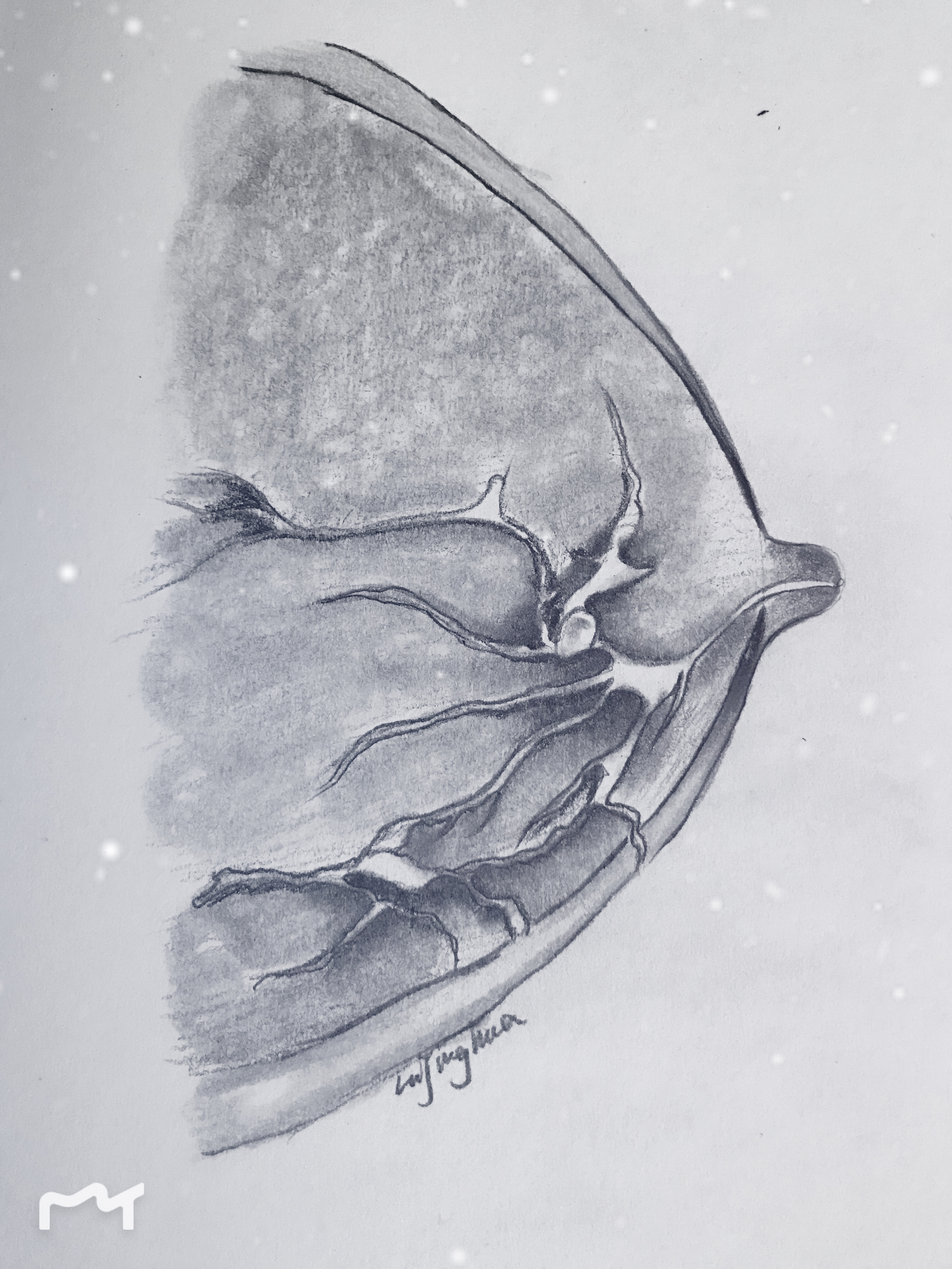 得了乳腺癌为什么不让来月经,得了乳腺癌为什么不愿切乳房