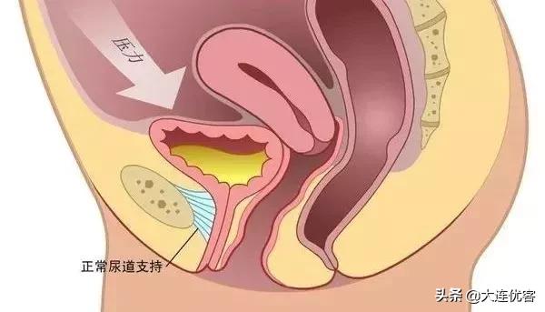 为什么女生尿尿需要纸巾擦,而男生不用?不能学男生抖抖吗?