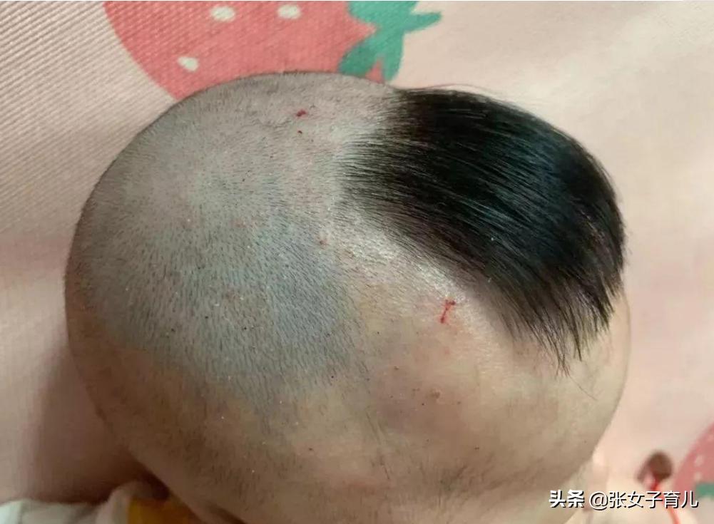 小宝宝头发稀少剃光头有用吗,新生儿头发剃光真的好吗