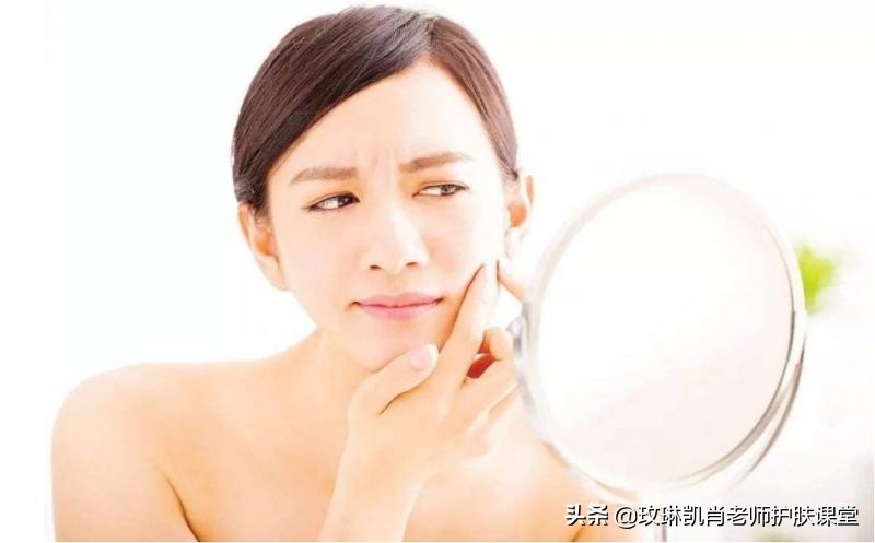 脸上长粉刺闭口什么原因造成的,脸上长闭口粉刺最有效的去除方法