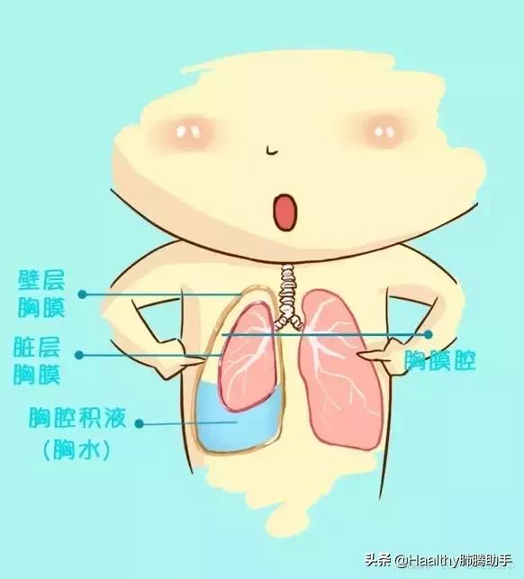 肺癌喘不过气来吃什么中药能缓解,肺癌喘不上气来怎么缓解