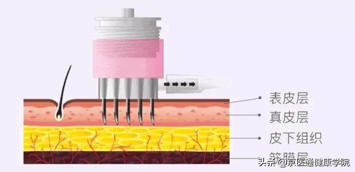 胶原蛋白真的有必要买吗,新手一定要知道的胶原蛋白骗局