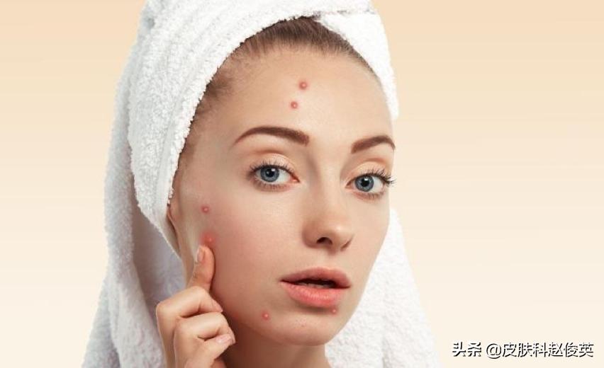 疮疡病病人的症状,疮是怎么引起的怎么治