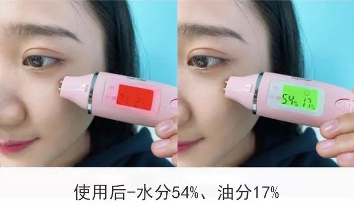 改善眼角细纹的方法有哪些,眼角皱纹细纹怎么去掉