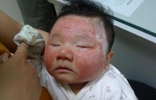 孕晚期怎么吃鹅蛋能更好的去胎毒,孕晚期怎么吃鹅蛋去胎毒