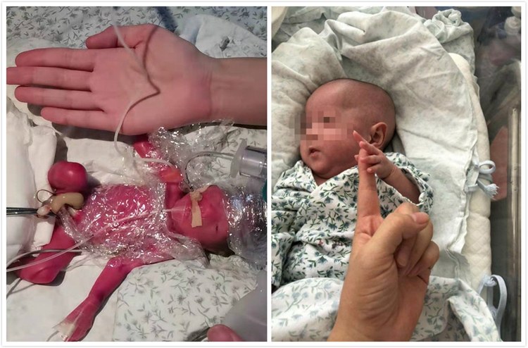 早产宝宝放弃治疗回家怎么办,早产27周宝宝可以放弃治疗吗