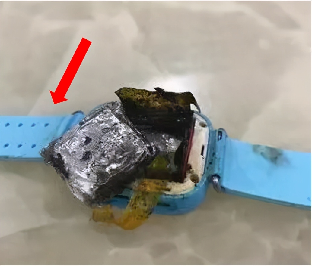 儿童电话手表为什么会烧伤,电话手表爆燃烧伤女童