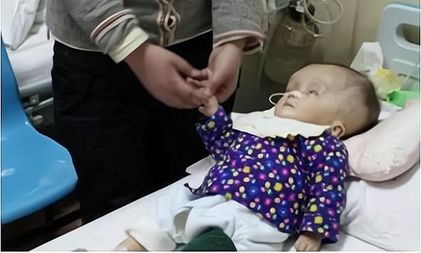 毒奶粉宝宝现状,毒奶粉事件的看法