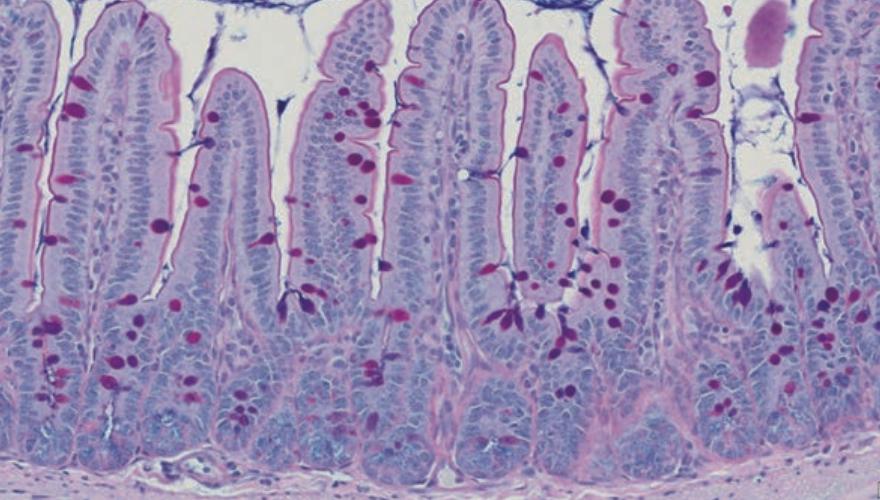 养乐多联手Nature设立全球肠道健康基金,今年花落谁家?