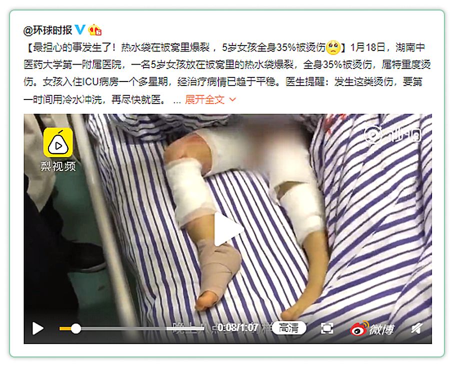 宝宝夏天25度薄睡袋还用盖被子吗,宝宝冬天穿了睡袋要不要盖被