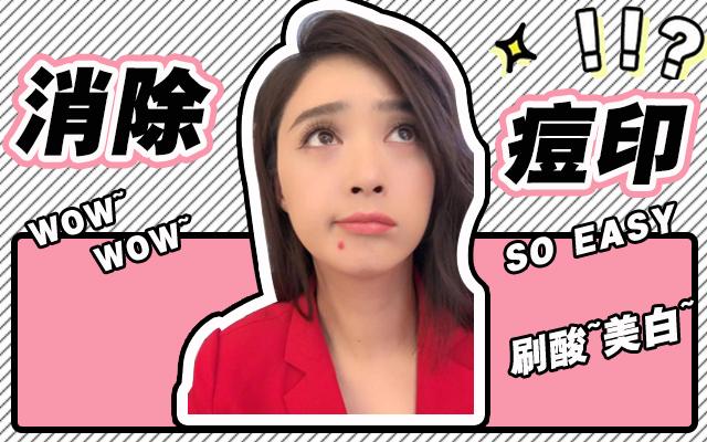 为什么痘印祛不了,为什么痘印去除不了