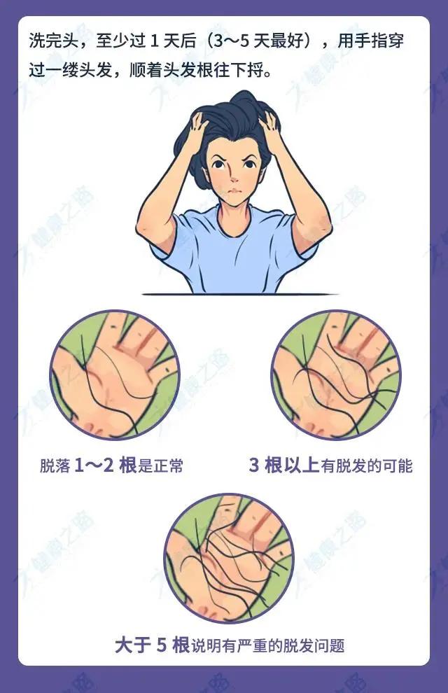 体毛能移植到眉毛么,体毛可以移植头发么