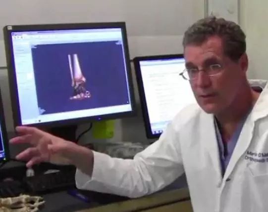 运动医学分析运动损伤案例,运动医学跟腱撕裂