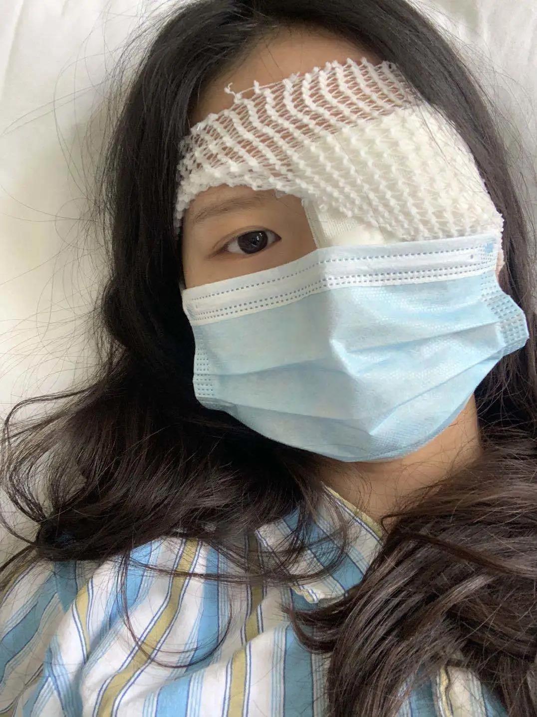 斜视手术吓人吗,斜视手术危险么