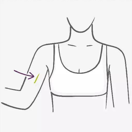 哺乳期妈妈如何避孕最有效,哺乳期妈妈纯孕激素疗法