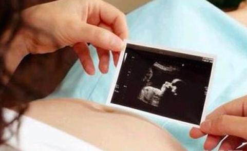 深夜产房：孕妈宫颈松，胎儿遇早产，给子宫扎口袋医生变裁缝