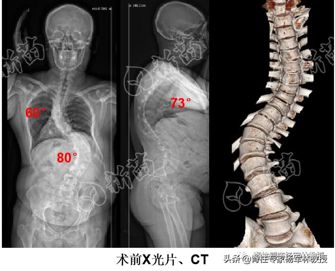 求医之路艰难的感慨,漫漫求医路感慨