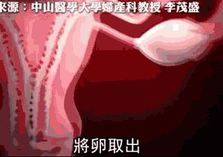 见过被扎过200次的卵巢吗？有女孩的家庭都该看看