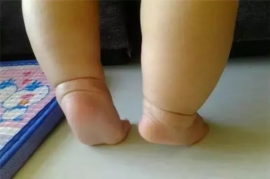 怎么让宝宝学走路的姿势,宝宝学走路前的忌讳