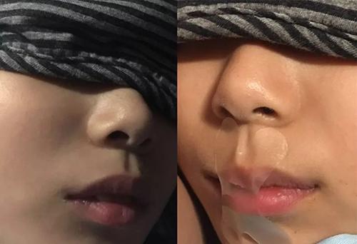 儿子长成“大嘴猴”,妈妈带去做检查,医生的话让她无地自容