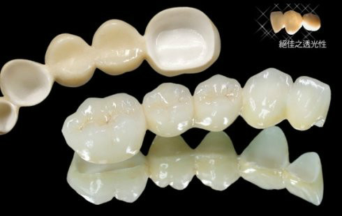 假牙价格一览表图片,假牙种类及价格表图片