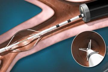 医生手术后最想做什么,医生做完手术以后会怎样