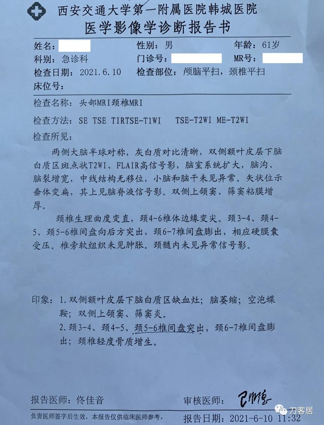 病例左侧躯体麻木,右侧肢体麻木典型病例