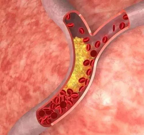 怀孕36周血压血糖高能够吃什么,孕妇血压140-100严重吗36周