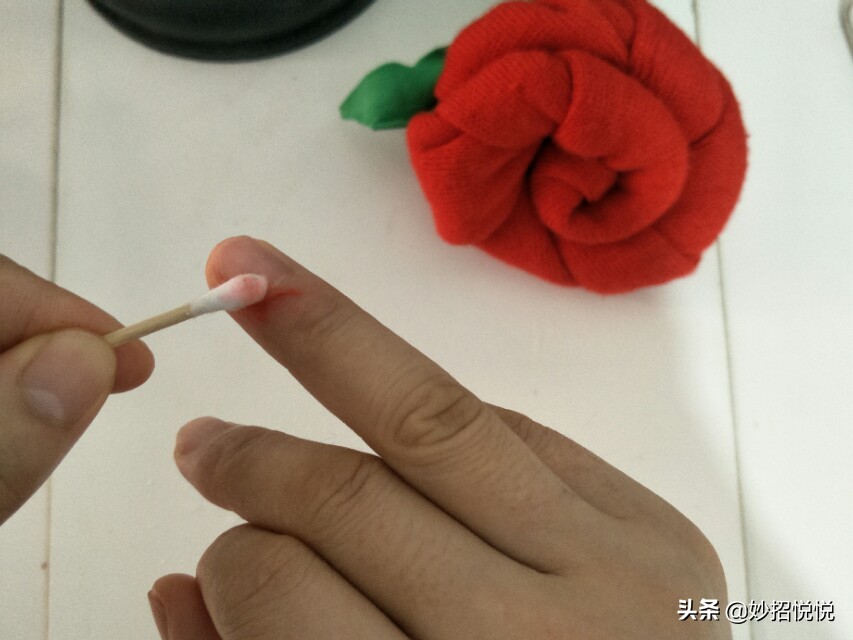 不知道被什么划伤的伤口怎么处理,被划破如何快速愈合