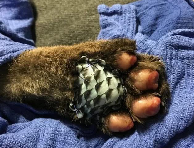 罗非鱼鱼皮治疗烧伤价格,罗非鱼鱼皮为什么对烧伤管用