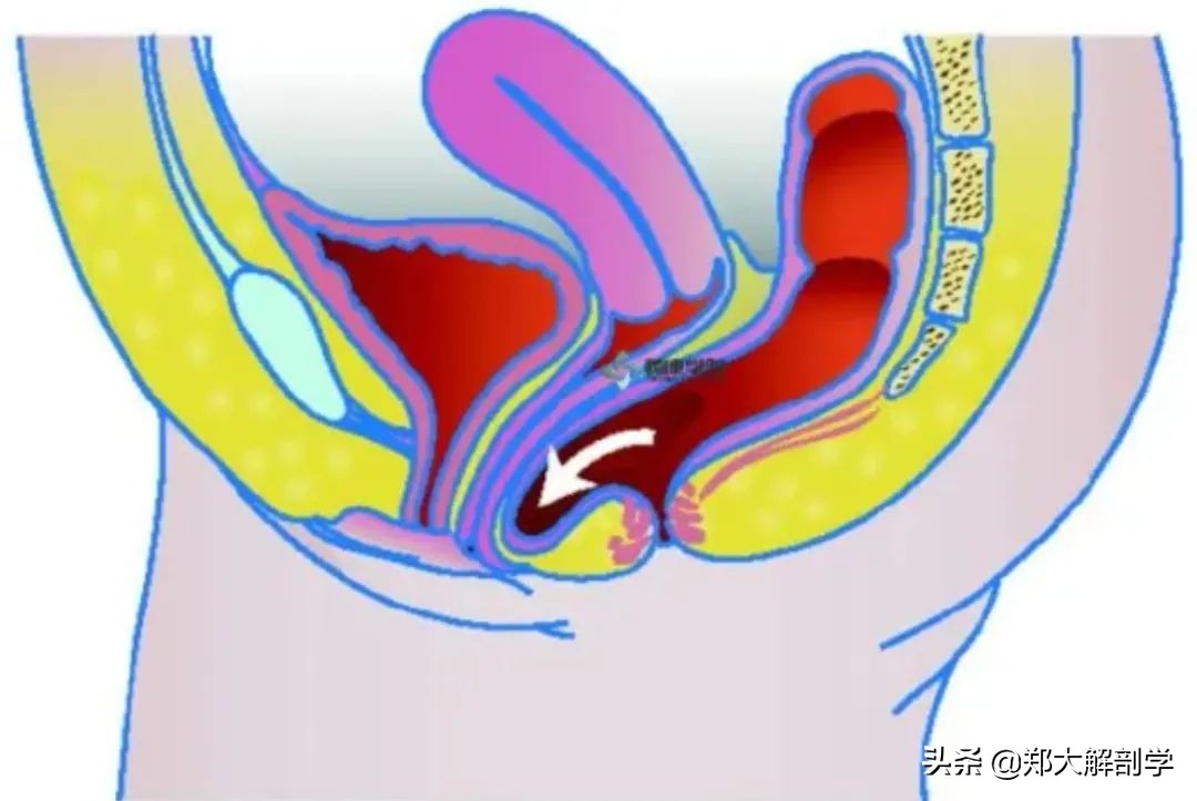女性盆底功能障碍性疾病表现,南通治疗盆底功能障碍的医院