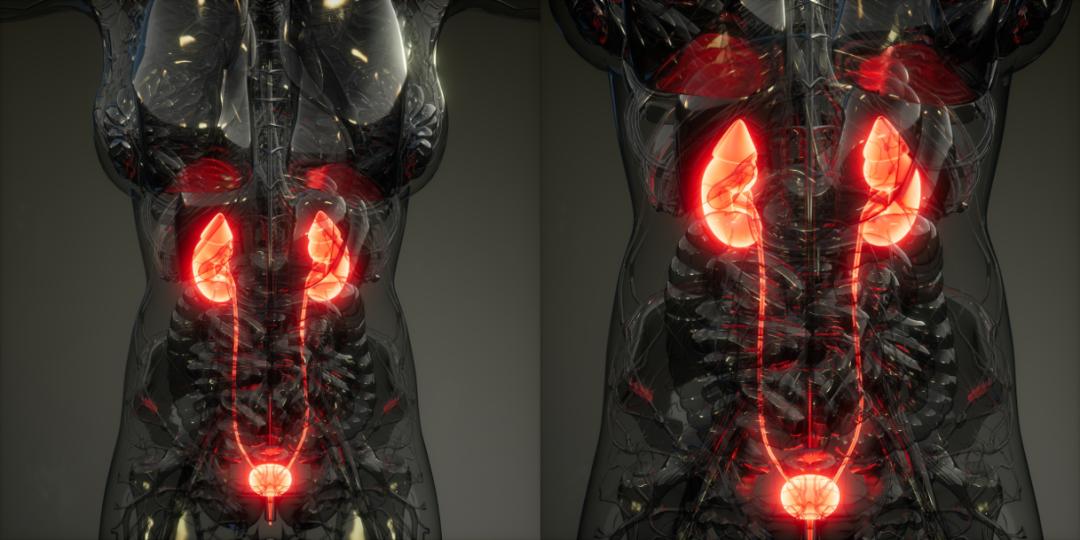 尿路感染一分钟就想上厕所怎么办,为什么尿路感染一到晚上就开始