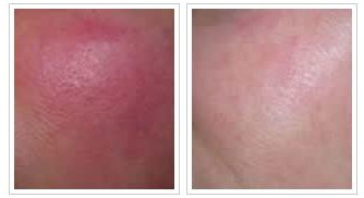 美白抗衰小知识,美白抗衰三件事