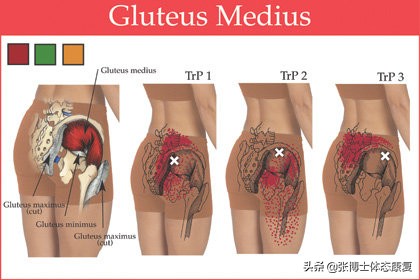 「功能训练」人体额状面稳定性与侧向子系统的关系