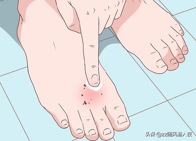 怎么处理狗咬伤口,狗咬伤口怎么处理