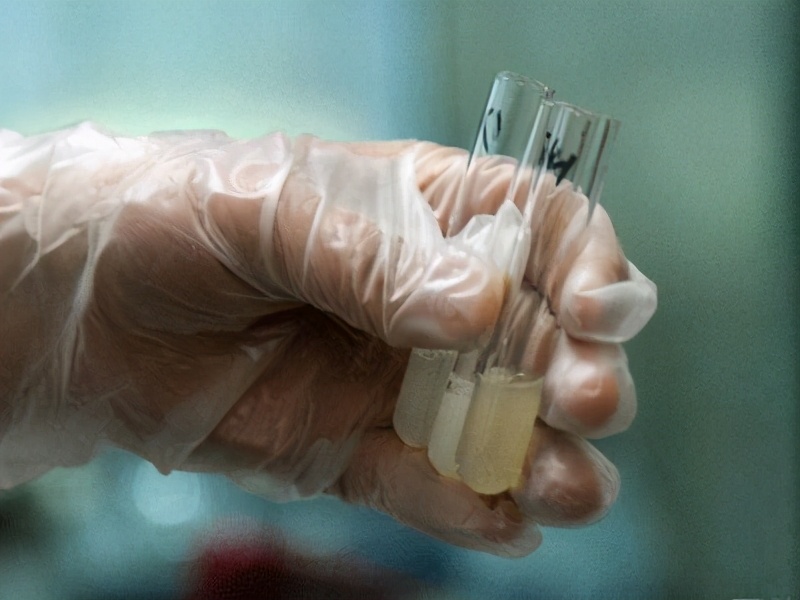 男性艾灸提高精子质量,男性怎么自检精子质量