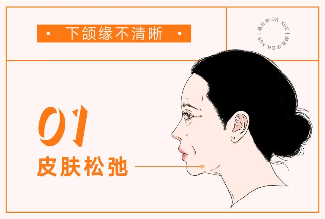 让下颚越来越清晰,下颌缘不清晰的原因